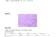 病理分析怎么做_病理报告多久能出