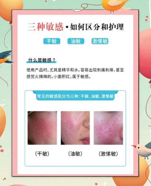 美容院怎么选_敏感肌适合做什么项目