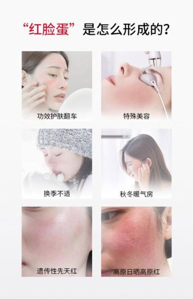 淘宝化妆品怎么选_敏感肌适合什么品牌