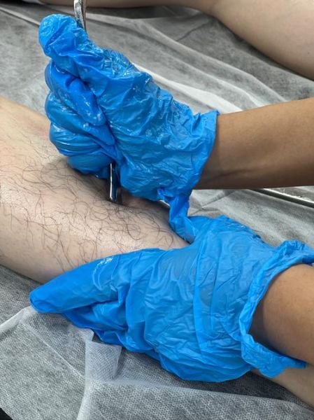 移动互联网医疗康复_如何在家完成专业康复训练