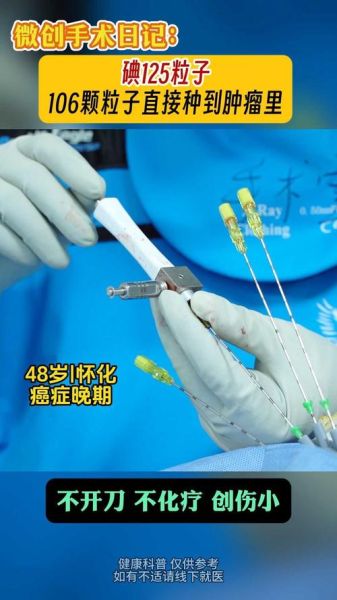 肿瘤治疗前景如何_最新突破有哪些