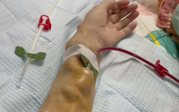 血透病人能活多久_血透一次多少钱