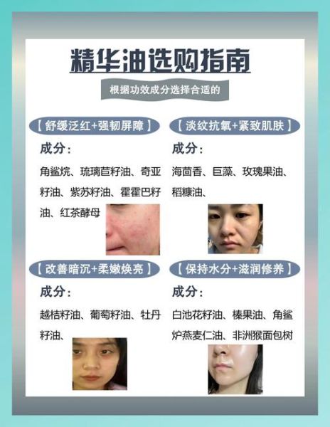 2024年护肤行业前景如何_敏感肌用什么成分最安全