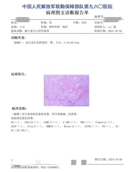 病理分析怎么做_病理报告多久能出