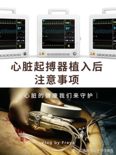 心脏起搏器能用多久_植入后注意事项