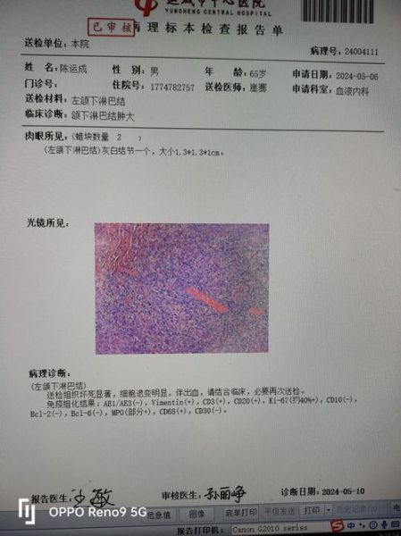 病理诊断准确率如何提高_病理诊断行业未来发展趋势