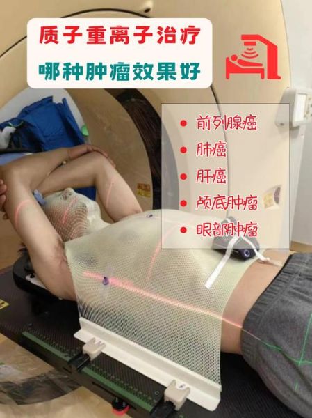 放疗前景怎么样_放疗能治愈癌症吗