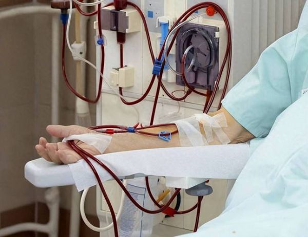血液透析能活多久_血液透析费用贵吗